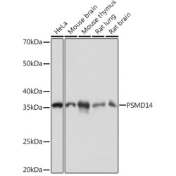 PSMD14 Rabbit mAb