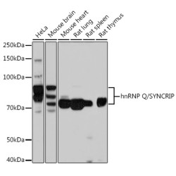 hnRNP Q/SYNCRIP Rabbit mAb
