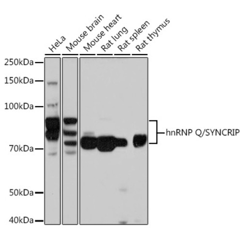 hnRNP Q/SYNCRIP Rabbit mAb
