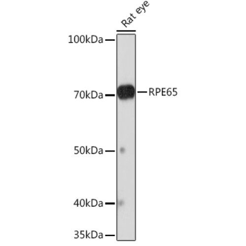 RPE65 Rabbit mAb