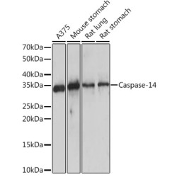 Caspase-14 Rabbit mAb
