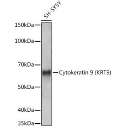 Cytokeratin 9 (KRT9) Rabbit mAb