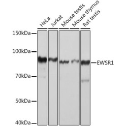 EWSR1 Rabbit mAb
