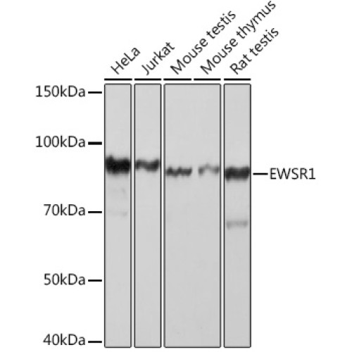EWSR1 Rabbit mAb