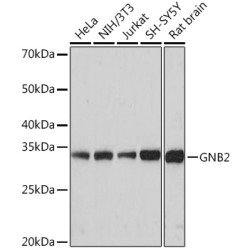 GNB2 Rabbit mAb