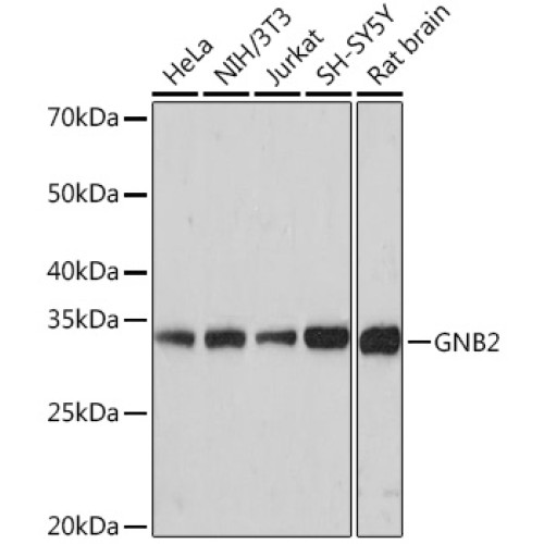 GNB2 Rabbit mAb