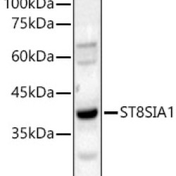 ST8SIA1 Rabbit pAb
