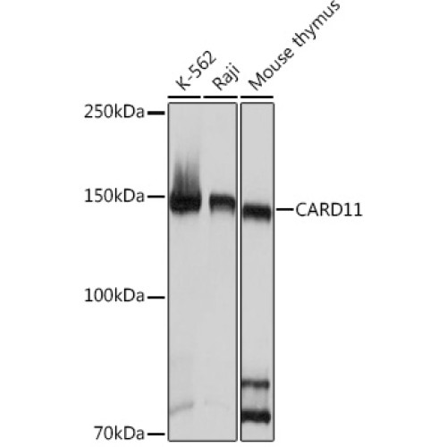 CARD11 Rabbit mAb