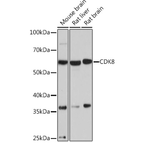 CDK8 Rabbit mAb