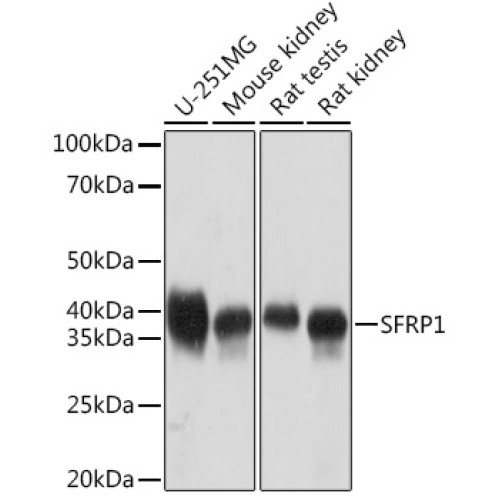 SFRP1 Rabbit mAb