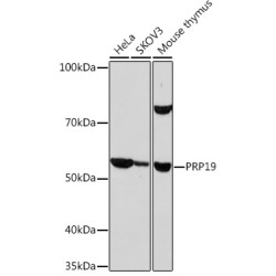 PRP19 Rabbit mAb
