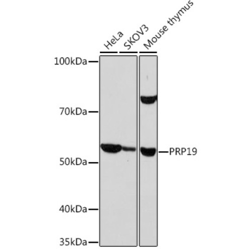 PRP19 Rabbit mAb