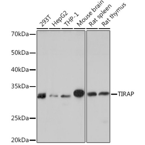 TIRAP Rabbit mAb