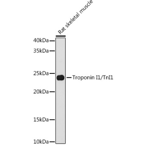 Troponin I1/TnI1 Rabbit mAb