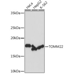 TOMM22 Rabbit mAb