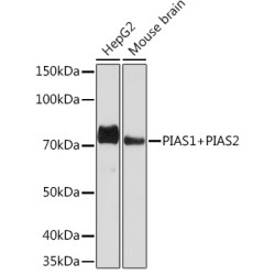 PIAS1+PIAS2 Rabbit mAb