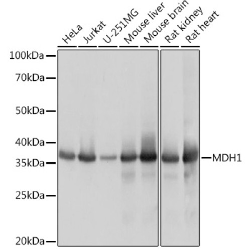 MDH1 Rabbit mAb