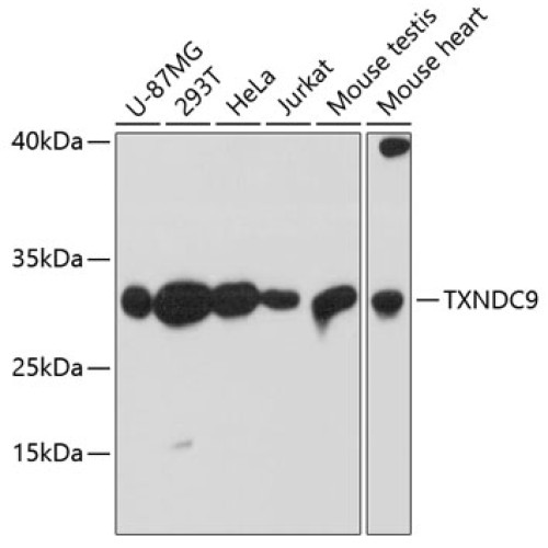 TXNDC9 Rabbit pAb