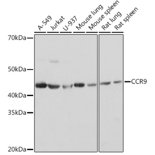 CCR9 Rabbit mAb