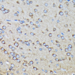 RALBP1 Rabbit mAb