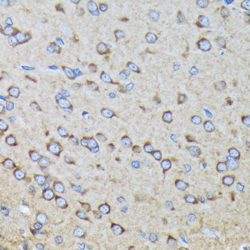 RALBP1 Rabbit mAb