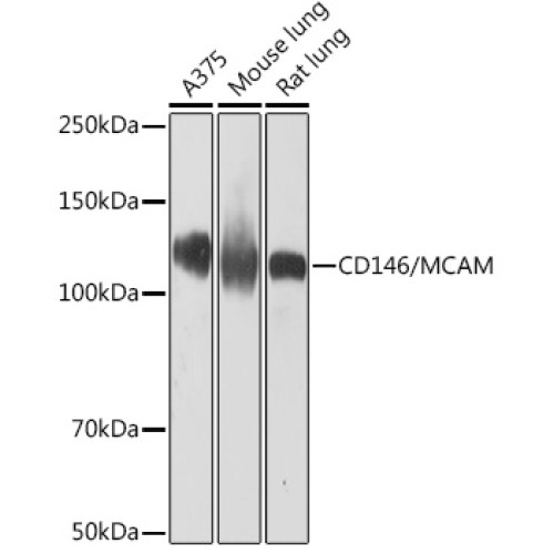 CD146/MCAM Rabbit mAb