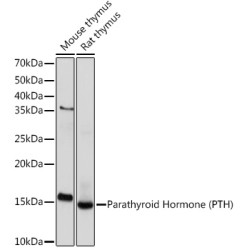 Parathyroid Hormone (PTH) Rabbit mAb