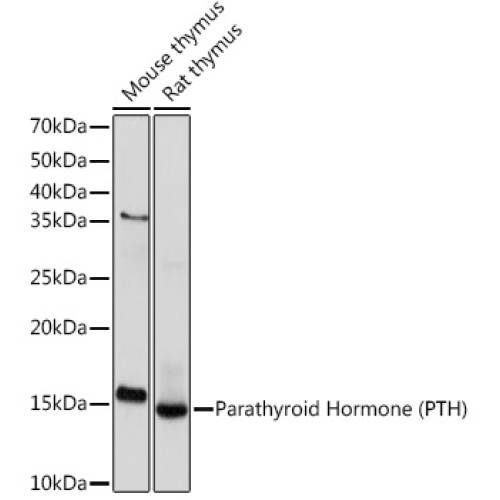 Parathyroid Hormone (PTH) Rabbit mAb