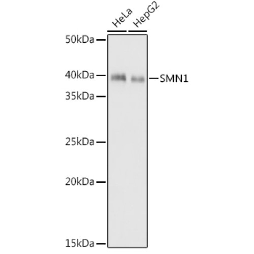 SMN1 Rabbit mAb