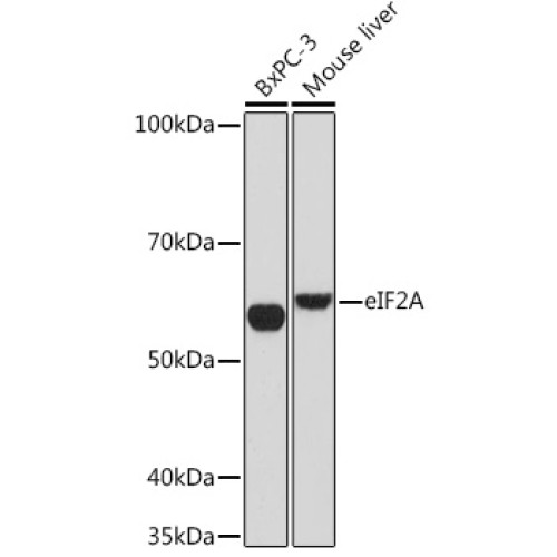 eIF2A Rabbit mAb