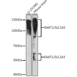 EAAT1/SLC1A3 Rabbit mAb