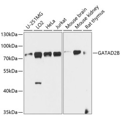 GATAD2B Rabbit pAb