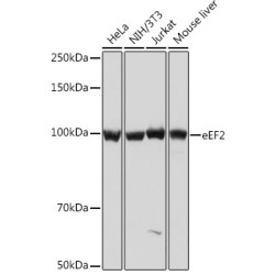 eEF2 Rabbit mAb