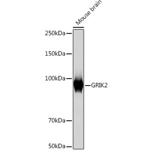 GRIK2 Rabbit mAb