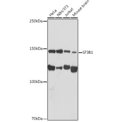 SF3B1 Rabbit mAb