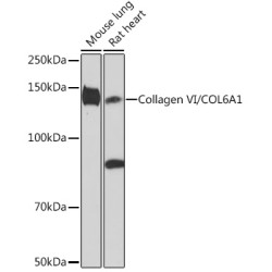 Collagen VI/COL6A1 Rabbit mAb