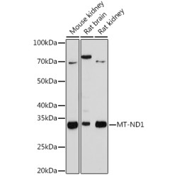 MT-ND1 Rabbit mAb