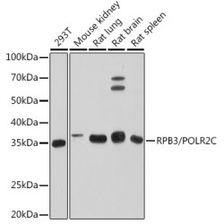 RPB3/POLR2C Rabbit mAb