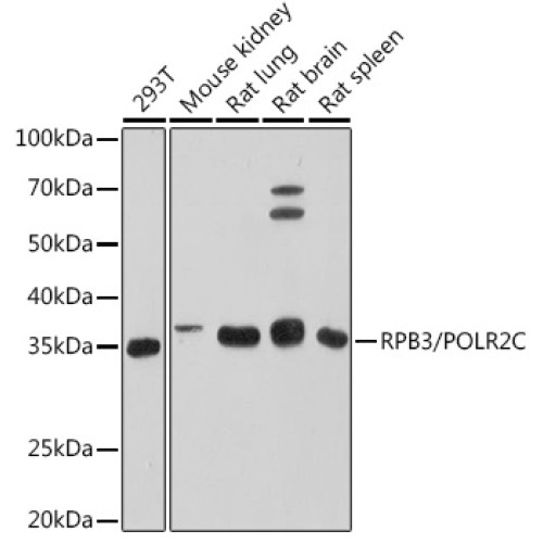 RPB3/POLR2C Rabbit mAb