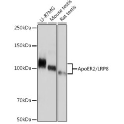 ApoER2/LRP8 Rabbit mAb