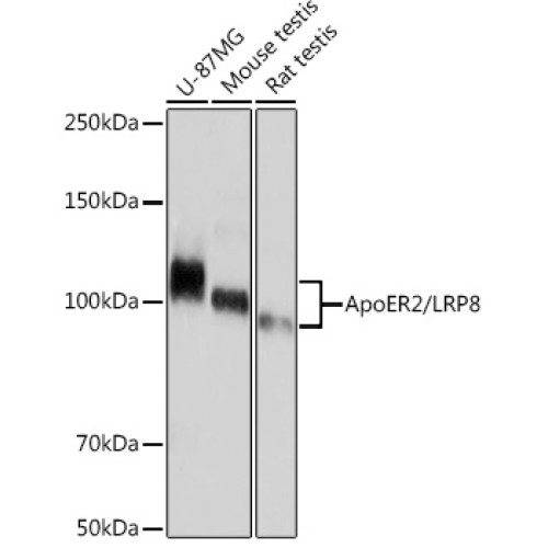 ApoER2/LRP8 Rabbit mAb