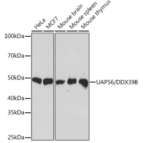 UAP56/DDX39B Rabbit mAb