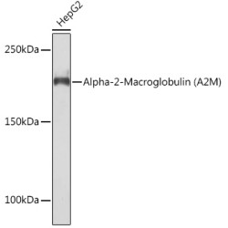 Alpha-2-Macroglobulin (A2M) Rabbit mAb