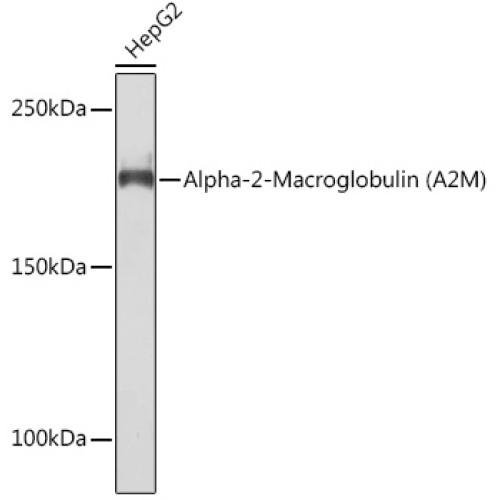 Alpha-2-Macroglobulin (A2M) Rabbit mAb