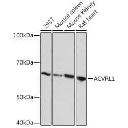 ACVRL1 Rabbit mAb
