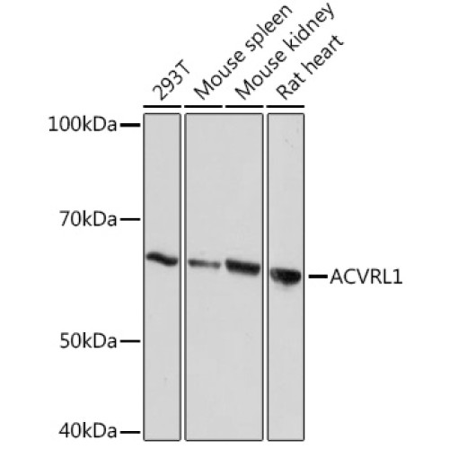 ACVRL1 Rabbit mAb
