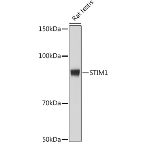 STIM1 Rabbit mAb