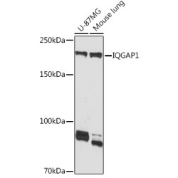 IQGAP1 Rabbit mAb