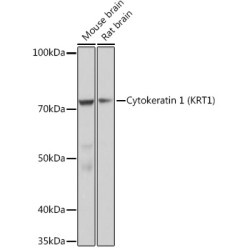 Cytokeratin 1 (KRT1) Rabbit mAb