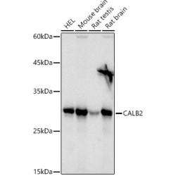 Calretinin Rabbit pAb